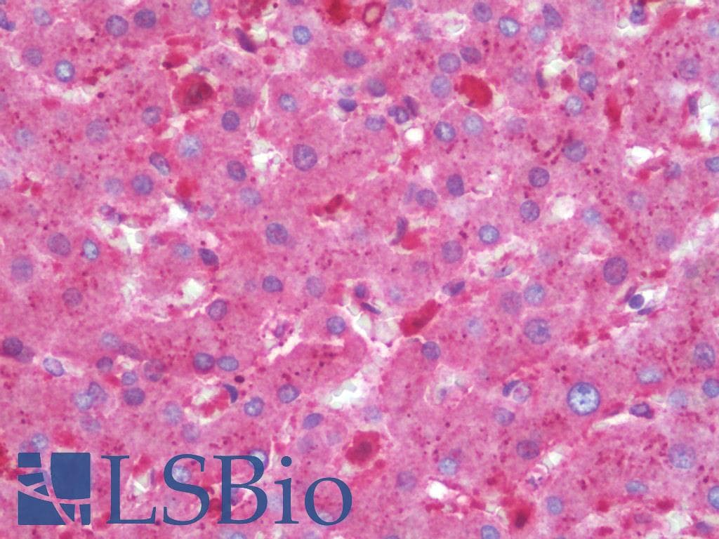 IHC-plus™ ADPRH / ARH1 Antibody (clone 1F11)