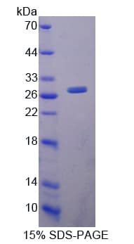 Rat ITGAL / CD11a Protein (Recombinant His-T7)