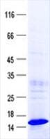 Human HEPN1 Protein (Recombinant His, N-Terminal)
