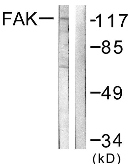 FAK / Focal Adhesion Kinase Antibody (p576)