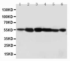 Polyclonal Rabbit anti-Human ABI1 / SSH3BP1 Antibody (aa483-494, IHC, WB)