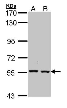 CAT / Catalase Antibody