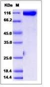 Human GPNMB / Osteoactivin Protein (Recombinant Human IgG Fc, C-terminus)