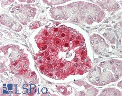 IHC-plus™ ACLY / ATP Citrate Lyase Antibody (aa350-400)