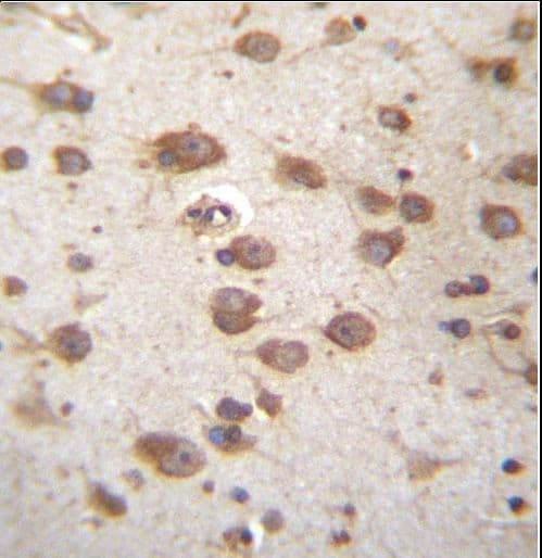 Polyclonal Rabbit anti-Human STAP2 Antibody (aa187-216, IHC, WB)
