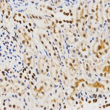 Polyclonal Rabbit anti-Human Histone H3 Antibody (IHC, IF, WB)