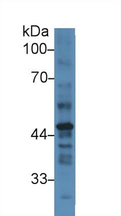 SERPINB2 / PAI-2 Antibody (aa170-393)