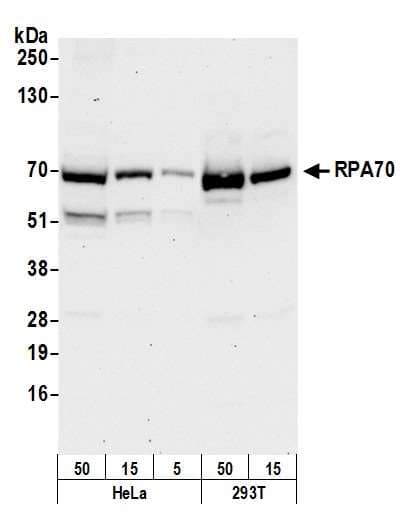 Polyclonal Rabbit anti-Human RPA70 / RPA1 Antibody (aa350-400, IHC, WB)