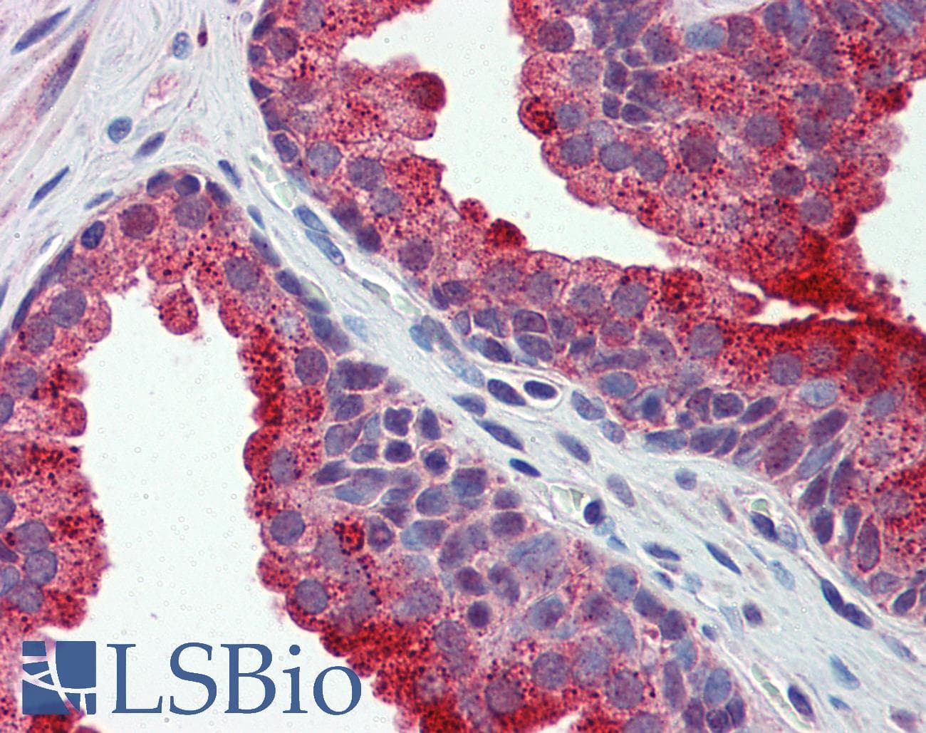 APH / APEH Antibody (aa144-193)