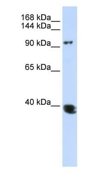 Polyclonal Rabbit anti-Human HDAC4 Antibody (N-Terminus, WB)