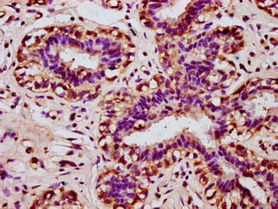 HOXA11 Antibody