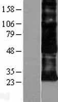 ADGRE5 / CD97 Protein (Over-Expression Lysate Myc-DDK (Flag))
