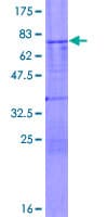 Human TSG101 Protein (Recombinant GST)