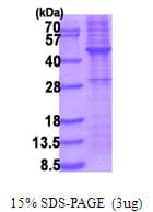 Human TRB3 / TRIB3 Protein (Recombinant His)
