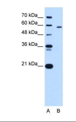 PKLR Antibody (aa56-105)
