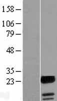 UBALD1 / FAM100A Protein (Over-Expression Lysate Myc-DDK (Flag))