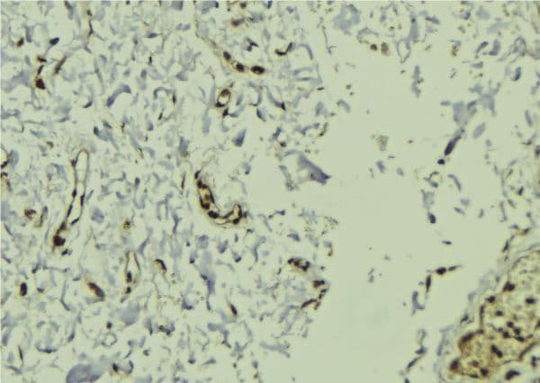 Polyclonal Rabbit anti-Human KIND2 / FERMT2 Antibody (IHC, WB)