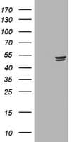 TP / Thymidine Phosphorylase Antibody (clone OTI4F4)