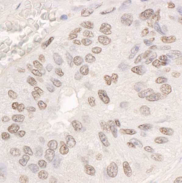 DDX17 Antibody (aa550-C-term)