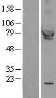 PKG / PRKG1 Protein (Over-Expression Lysate Myc-DDK (Flag))