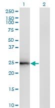 Monoclonal Mouse anti-Human CIDEB Antibody (clone 2A10, IHC, WB)