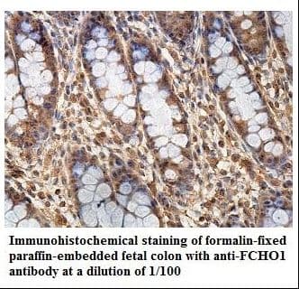 Polyclonal Rabbit anti-Human FCHO1 Antibody (aa19-194, IHC, WB)