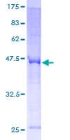 Human FSP27 / CIDEC Protein (Recombinant GST)