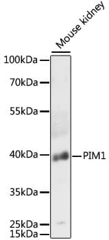 PIM1 / Pim-1 Antibody