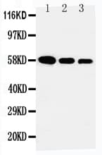 Polyclonal Rabbit anti-Human AHSG / Fetuin A Antibody (aa46-62, WB)