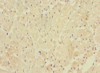 Polyclonal Rabbit anti-Human FBXO40 Antibody