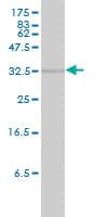 HMOX2 / Heme Oxygenase 2 Antibody (clone 1D8-1A8)