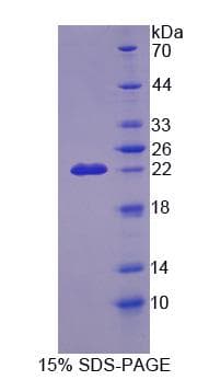 Mouse CDKN2D / p19 INK4d Protein (Recombinant)