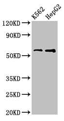 FSCN1 / Fascin Antibody