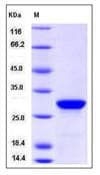 Human PTH / Parathyroid Hormone Protein (Recombinant GST, N-terminus)