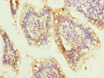 Polyclonal Rabbit anti-Human QRSL1 / GatA Antibody (IHC)