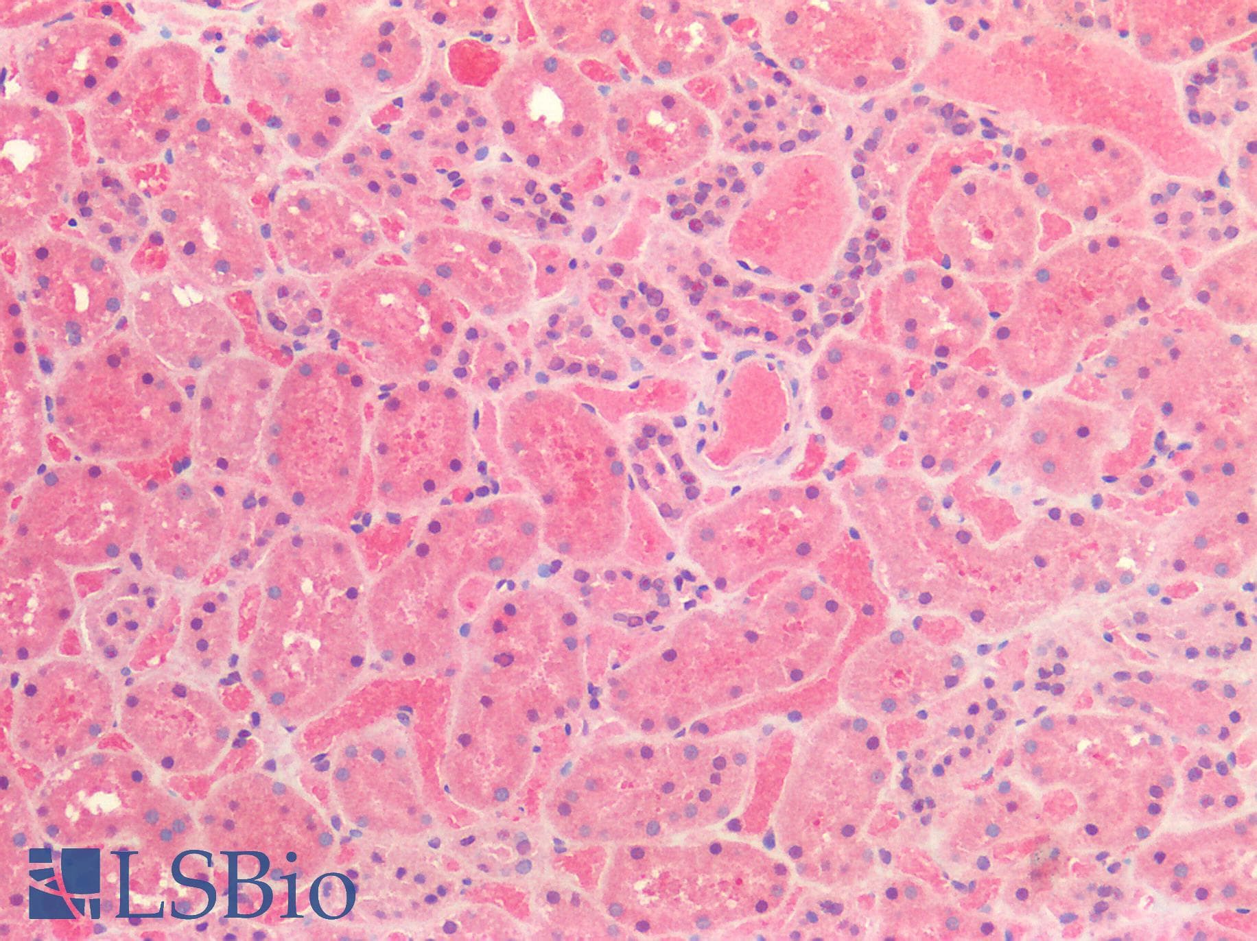 IHC-plus™ HDAC6 Antibody