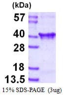 Human CLTA / LCA Protein (Recombinant His)