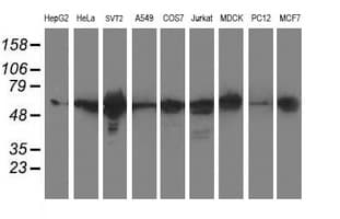 XPNPEP3 Antibody (clone OTI2D5)