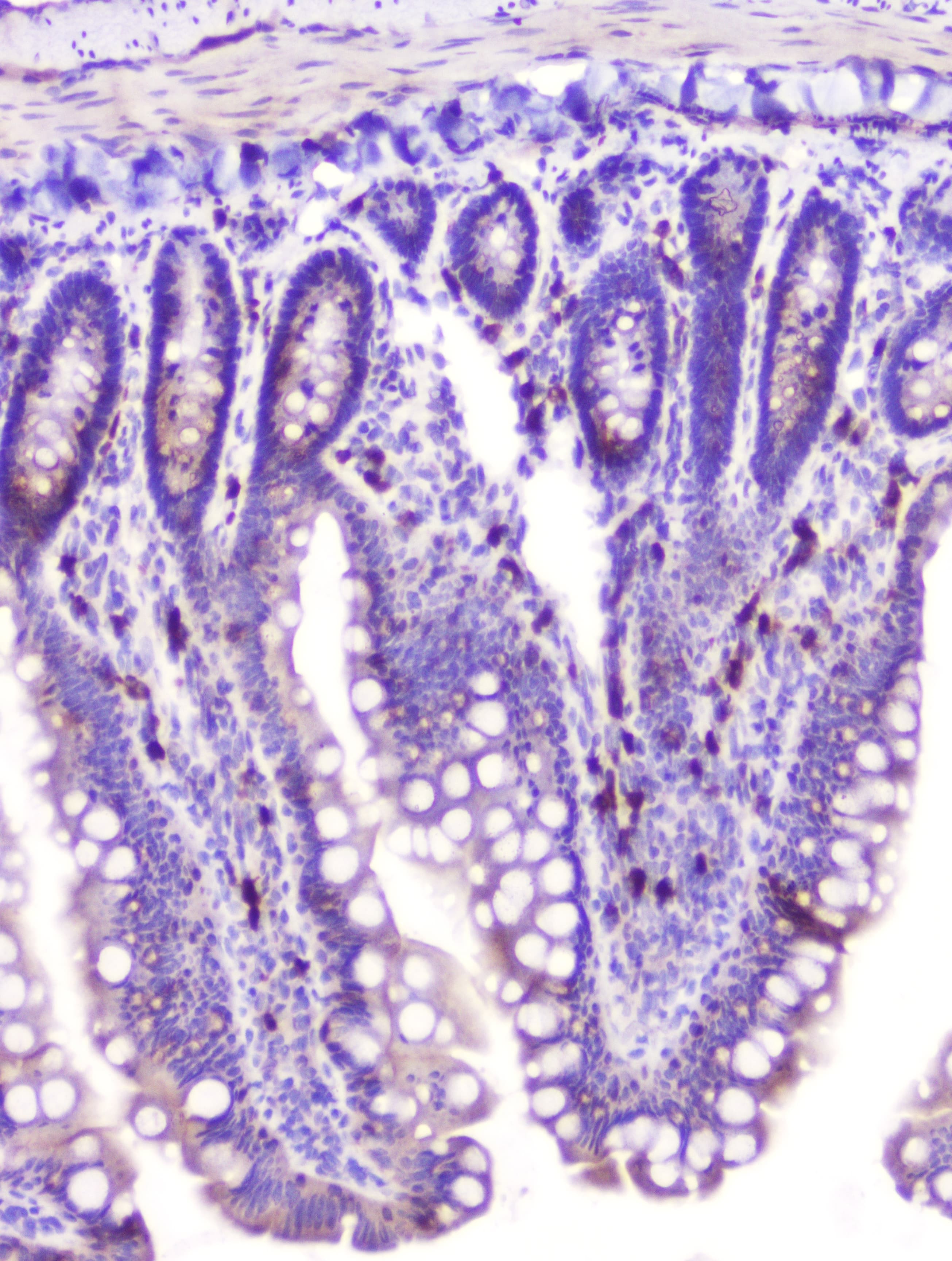 RASAL1 / RASAL Antibody