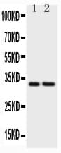 CD20 Antibody