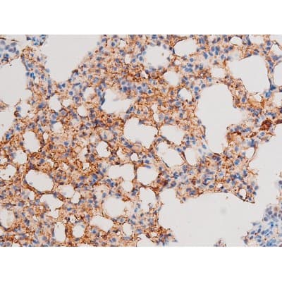 SMAD3 Antibody (phospho-Ser213)