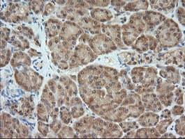 MAP2K1 / MKK1 / MEK1 Antibody (clone OTI2B7)