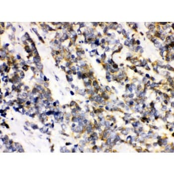 ATXN3 / JOS Antibody (aa226-254)