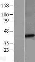 SGCB / SGC / Sarcoglycan Beta Protein (Over-Expression Lysate Myc-DDK (Flag))