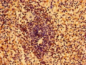 HLA-B Antibody