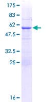 Human ABCC10 Protein (Recombinant GST)