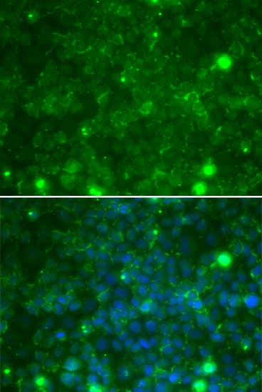 Polyclonal Rabbit anti-Human TIMP3 Antibody (IHC, IF, WB)