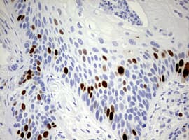 TOP2A / Topoisomerase II Alpha Antibody (aa1100-1531, clone OTI1D5)