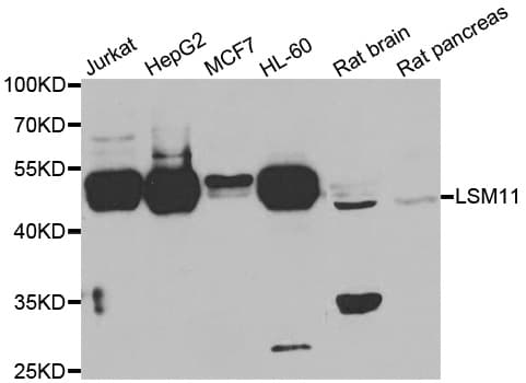 LSM11 Antibody