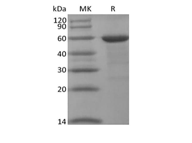 Human BRD4 Protein (Recombinant 10His, N-terminus)